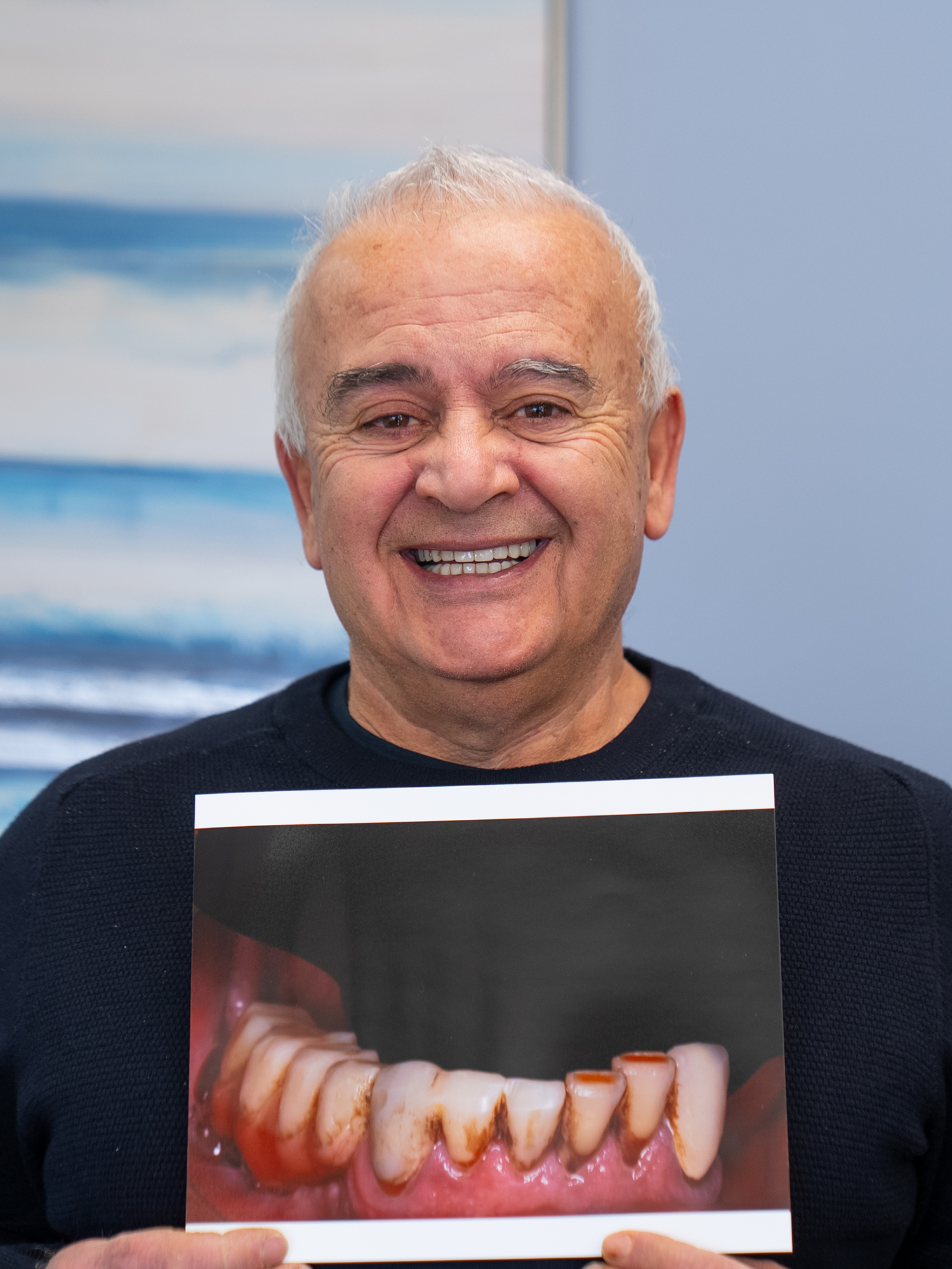 Dr.Young's patient smiling and holding up a before photo